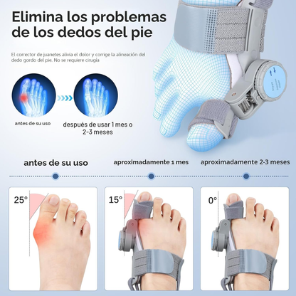 Corrector de Juanetes Ortopédico